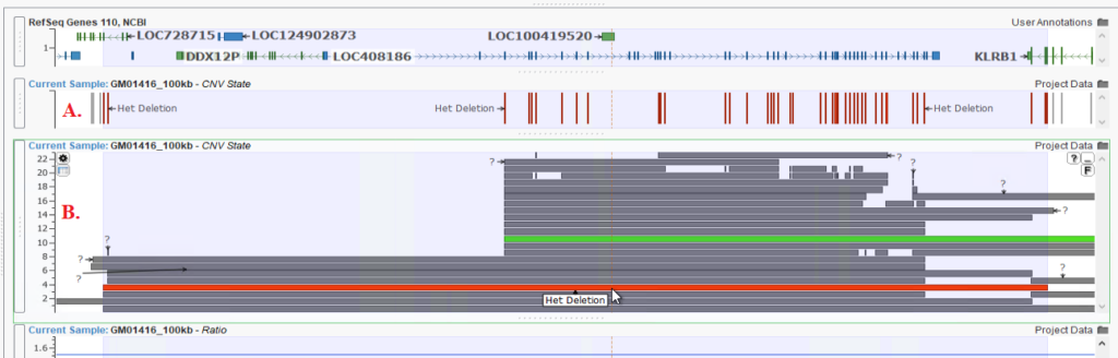 Figure 2 A: Multiple Small Het Deletions across a target.
B: The Het Deletions being called correctly as one larger CNV event.
