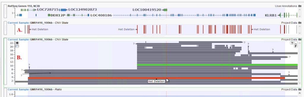 Figure 2 A: Multiple Small Het Deletions across a target. 
B: The Het Deletions being called correctly as one larger CNV event. 