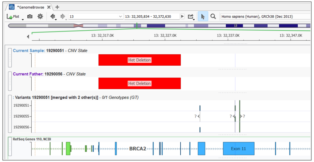 Figure 2. Trio analysis depicting compound heterozygosity between a SNP and CNV in Genome Browse.